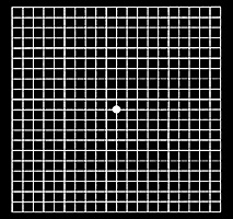 加齢黄斑変性チェック用の格子の図